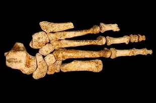 &Oacute;sos do p&eacute; dun individuo desta especie