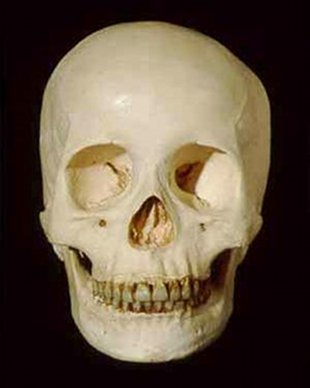 Cranio dun Homo sapiens sapiens
