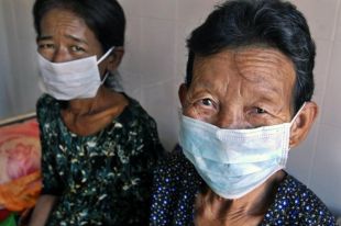 A tuberculose provoca arredor de 1,7 millóns de mortes ao ano